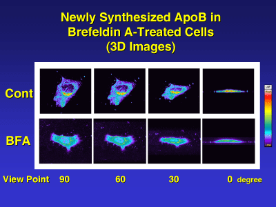 Chart: Newly Synthesized ApoB in Brefeldin A-Treated Cells.